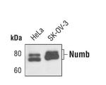 NUMB Antibody in Western Blot (WB)