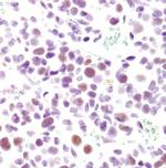 CDK9 Antibody in Immunohistochemistry (Paraffin) (IHC (P))