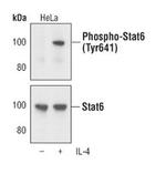 Phospho-STAT6 (Tyr641) Antibody in Western Blot (WB)