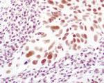 LSD1 Antibody in Immunohistochemistry (Paraffin) (IHC (P))