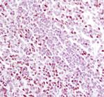 TCF7 Antibody in Immunohistochemistry (Paraffin) (IHC (P))