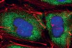 eIF4G Antibody in Immunocytochemistry (ICC/IF)