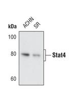 STAT4 Antibody in Western Blot (WB)