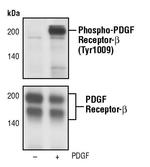 Phospho-PDGFRB (Tyr1009) Antibody in Western Blot (WB)