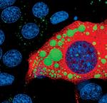 ATGL Antibody in Immunocytochemistry (ICC/IF)