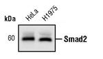 SMAD2 Antibody in Western Blot (WB)