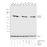 RICTOR Antibody in Western Blot (WB)