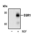 EGR1 Antibody in Western Blot (WB)