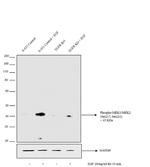 Phospho-MEK1/MEK2 (Ser217, Ser221) Antibody in Western Blot (WB)