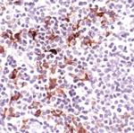 TRAF1 Antibody in Immunohistochemistry (Paraffin) (IHC (P))