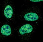 Phospho-STAT1 (Tyr701) Antibody in Immunocytochemistry (ICC/IF)