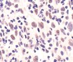 MRE11 Antibody in Immunohistochemistry (Paraffin) (IHC (P))