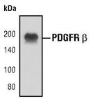 PDGFRB Antibody in Western Blot (WB)