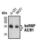 hnRNP A2B1 Antibody in Western Blot (WB)