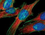 S6 Antibody in Immunocytochemistry (ICC/IF)