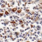 STAT1 Antibody in Immunohistochemistry (Paraffin) (IHC (P))