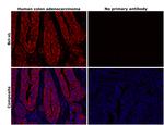 Bcl-xL Antibody in Immunohistochemistry (Paraffin) (IHC (P))