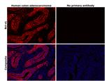 Bcl-xL Antibody in Immunohistochemistry (Paraffin) (IHC (P))