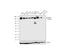 PDGFRB Antibody in Western Blot (WB)