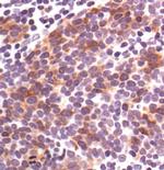 Phospho-Cdc25C (Ser216) Antibody in Immunohistochemistry (Paraffin) (IHC (P))