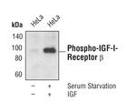 Phospho-IR/IGF1R beta (Tyr1135, Tyr1136, Tyr1150, Tyr1151) Antibody in Western Blot (WB)