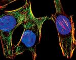 Phospho-MYL9 (Ser19) Antibody in Immunocytochemistry (ICC/IF)