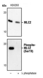 Phospho-MYL9 (Ser19) Antibody in Western Blot (WB)