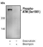 Phospho-ATM (Ser1981) Antibody in Western Blot (WB)