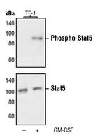 Phospho-STAT5 alpha (Tyr694) Antibody