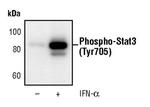 Phospho-STAT3 (Tyr705) Antibody in Western Blot (WB)