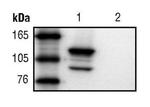 beta Galactosidase Antibody in Western Blot (WB)