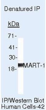 Melan-A Antibody in Immunoprecipitation (IP)