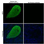 Cytokeratin 5 Antibody in Immunohistochemistry (Paraffin) (IHC (P))