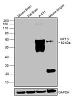 Cytokeratin 5 Antibody in Western Blot (WB)