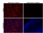 S100B Antibody in Immunohistochemistry (Paraffin) (IHC (P))