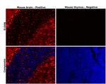 S100B Antibody