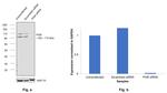 Progesterone Receptor Antibody