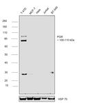 Progesterone Receptor Antibody in Western Blot (WB)