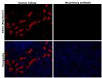 CD10 Antibody in Immunohistochemistry (Paraffin) (IHC (P))