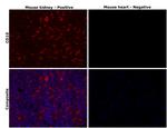 CD10 Antibody in Immunohistochemistry (Paraffin) (IHC (P))