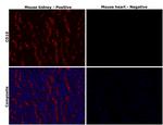 CD10 Antibody in Immunohistochemistry (Paraffin) (IHC (P))