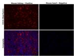 CD10 Antibody