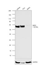 SKP2 Antibody in Western Blot (WB)