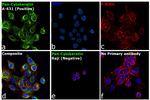 Cytokeratin Pan Antibody in Immunocytochemistry (ICC/IF)