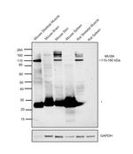 MUSK Antibody