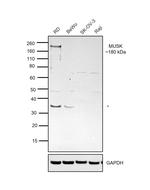 MUSK Antibody in Western Blot (WB)