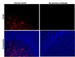 CD38 Antibody in Immunohistochemistry (Paraffin) (IHC (P))