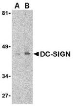 DC-SIGN Antibody in Western Blot (WB)