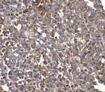 ORAI1 Antibody in Immunohistochemistry (IHC)