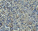 ORAI1 Antibody in Immunohistochemistry (IHC)